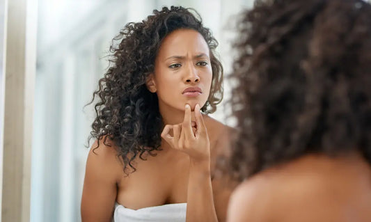 Puraz RAW Collagen Powder beside breakfast and skincare as a person considers whether collagen can cause acne