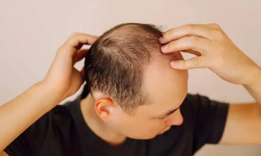 Woman with protein-rich foods and collagen capsules for a low protein hair loss guide