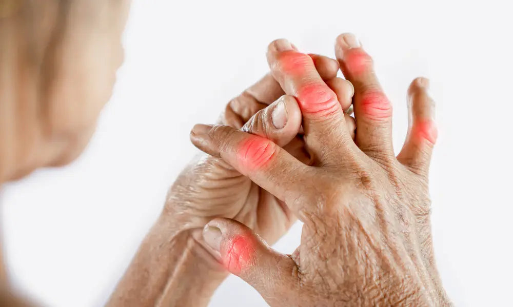 Joint Supplements for Hands and Fingers NZ: What Should You Look For?