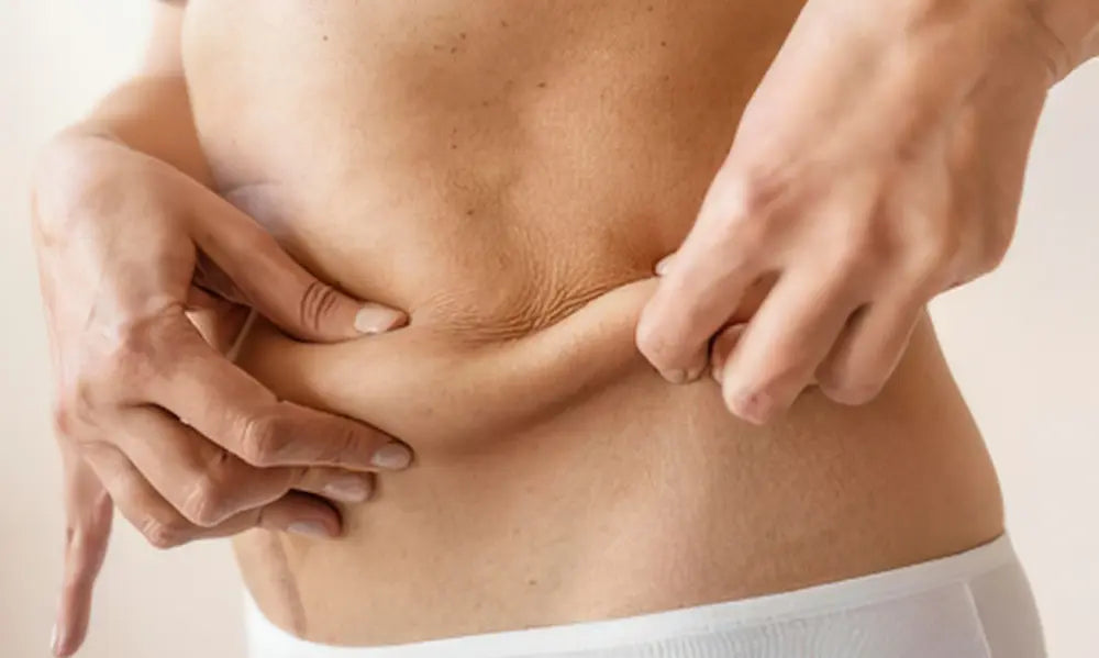 Adult after weight loss considering skin elasticity and collagen support