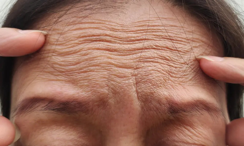 Which Collagen Is Best for Wrinkles in NZ? A Skin-First Answer Pasted text