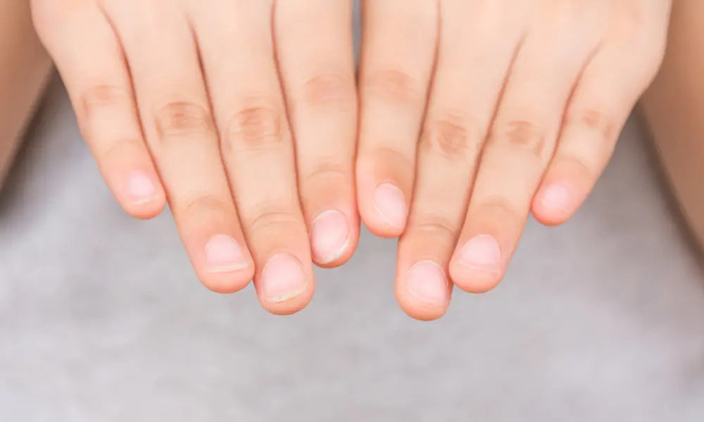 Natural fingernails showing new growth from the base to the tip for a guide to slow nail growth