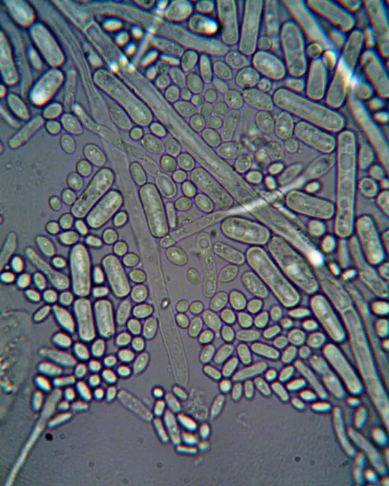 Microbiome support beyond capsules